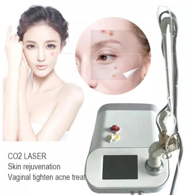 Portable Fractional Co2 Laser Machine NP03-1